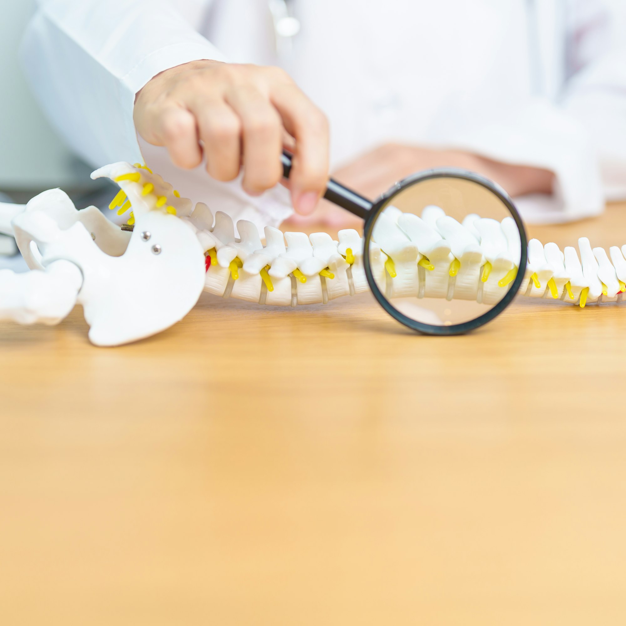 Doctor with human Spine anatomy model. Spinal Cord Disorder