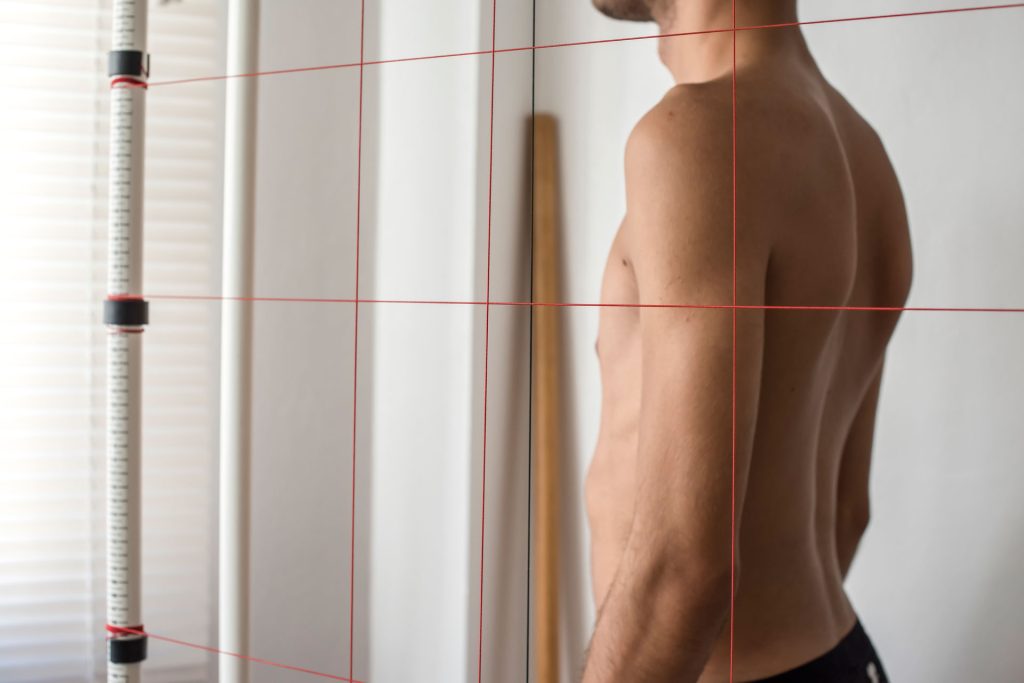 Man with misaligned body parts in chiropractor office.