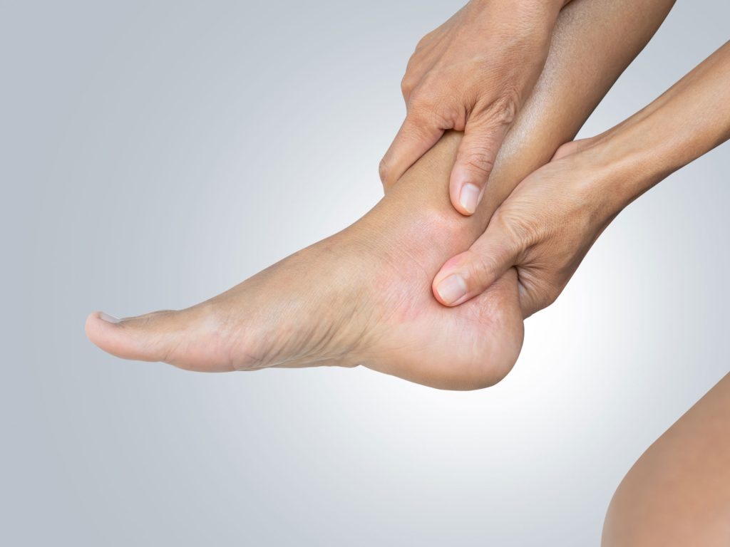 Feet with plantar fasciitis suffering from heel pain.